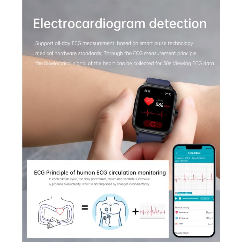 ET540 Glucosa en sangre ECG Temperatura corporal Presión arterial Oxígeno en sangre Frecuencia cardíaca Llamada Bluetooth Smartwatch Fitness Tracker