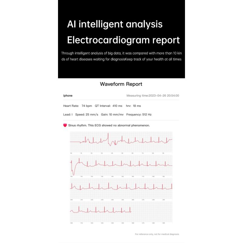 ET540 Glucosa en sangre ECG Temperatura corporal Presión arterial Oxígeno en sangre Frecuencia cardíaca Llamada Bluetooth Smartwatch Fitness Tracker