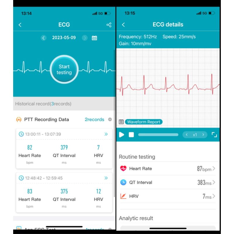 ET540 Glucosa en sangre ECG Temperatura corporal Presión arterial Oxígeno en sangre Frecuencia cardíaca Llamada Bluetooth Smartwatch Fitness Tracker