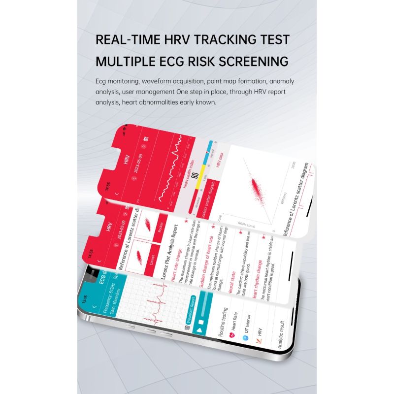 ET540 Glucosa en sangre ECG Temperatura corporal Presión arterial Oxígeno en sangre Frecuencia cardíaca Llamada Bluetooth Smartwatch Fitness Tracker