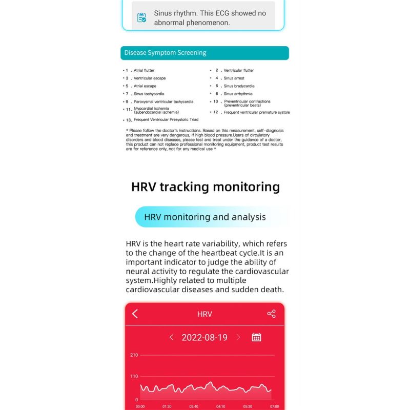 EP01 glucosa en sangre azúcar reloj inteligente ECG  PPG HRV frecuencia cardíaca temperatura 1,47 
