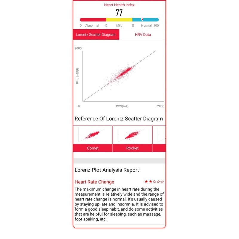 EP01 glucosa en sangre azúcar reloj inteligente ECG  PPG HRV frecuencia cardíaca temperatura 1,47 